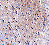 Antibody product image